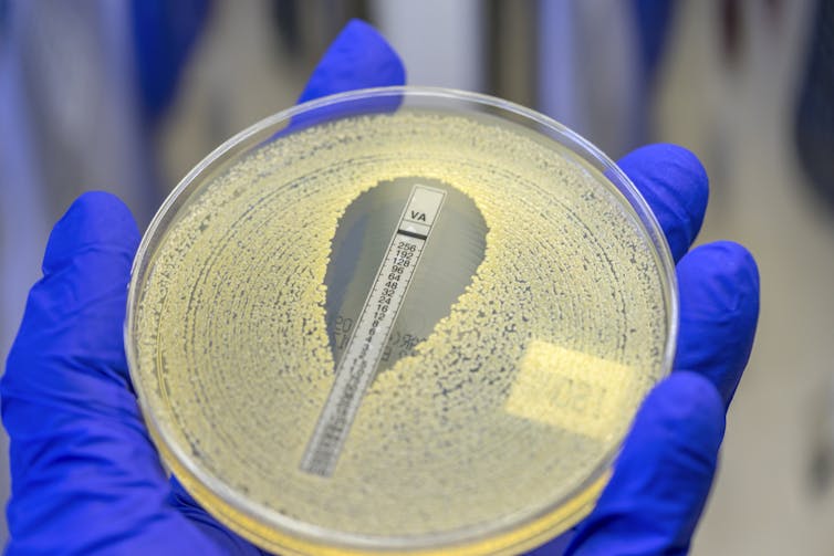 A gloved hand holds a Petri dish, which is covered with a bacterial film except for a small area around the plastic strip.